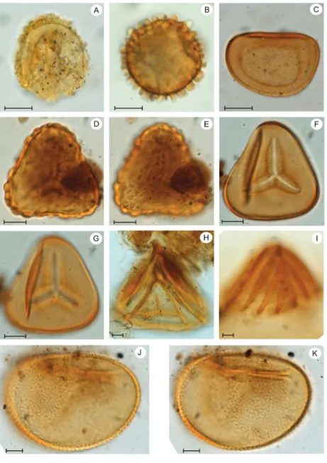 Figura 4. Esporos: A. Selaginellaceae: Selaginella asperula.  B. Selaginellaceae: 