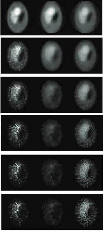 Figure 2. From top to bottom: The mean of Shepp-Logan phantom images reconstructed based on noisy system matrix with relative error 0%, 3%, 6%, 9%, 12%, and 15%