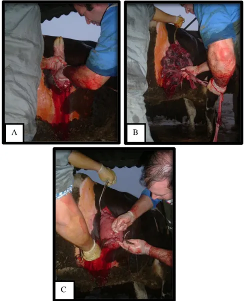 Figura 31. Cesariana: A- Incisão no útero e extracção do feto; B- Extracção das membranas fetais; 
