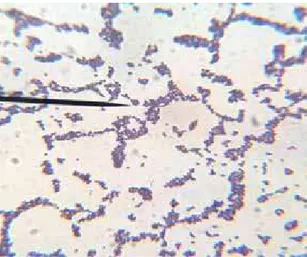 Fig. 4: Infection with Streptococcus pyogenes  Gram stain.  (100X). 