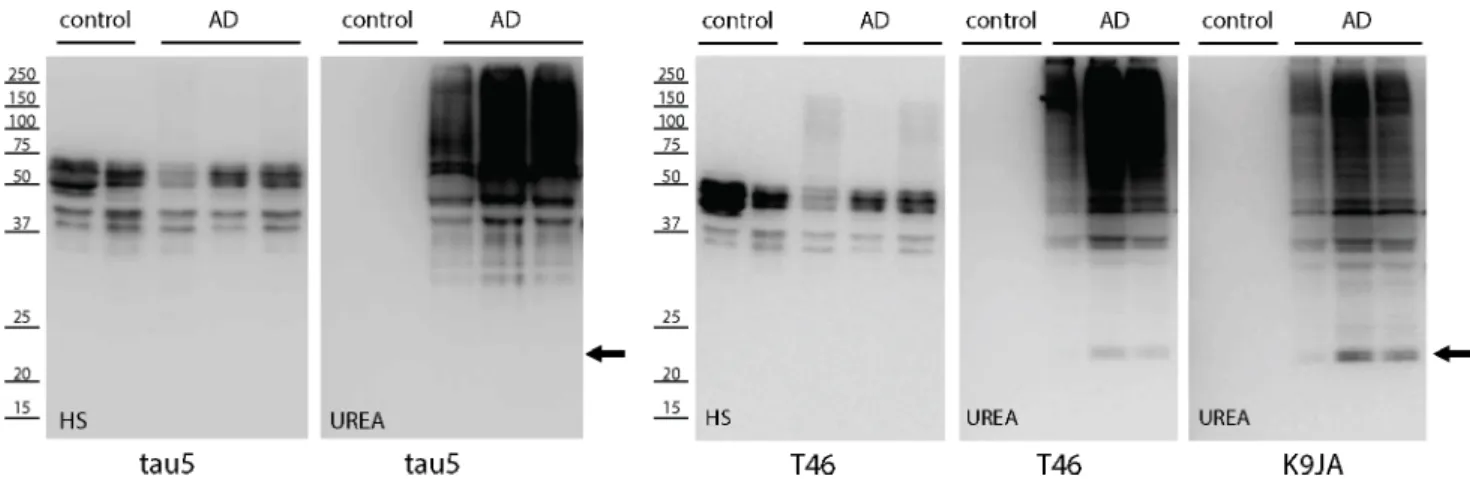 Fig 6. The generation of ~24 kDa but not ~17 and 12 kDa C-terminal tau fragments in AD brain
