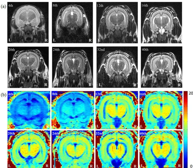 Fig 1. The anatomical MR images, (a) T2W images and (b) R2 mapping, in 4- to 40-week-old developing rabbit brains