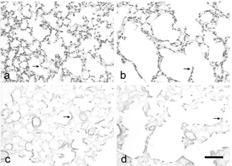 Fig. 1. Photomicrographs of lung sections from control mice (panels a and c) and animals exposed to cigarette smoke (CS) over a 60-day period (panels b and d), showing details of the alveolar septa (a and b) and elastic fibers (c and d)