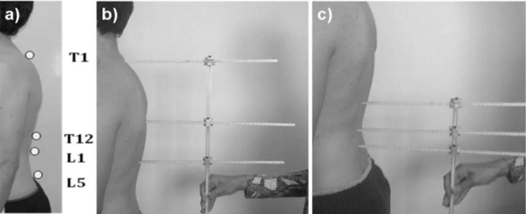 Figura 2. Avaliação da coluna vertebral: (a) marcação dos pontos anatômicos e mensuração com o  arcômetro (b) da região torácica e (c) da região lombar