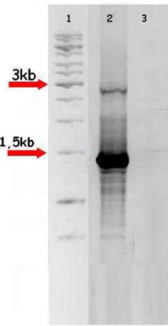 Figura 4 - Produtos de amplificação oriundos do PCR secundário do GW para o gene SP. 1
