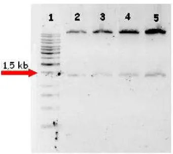 Figura  10  –  Análise  de  digestão  dos  clones  recombinantes  contendo  a  região  promotora  do  gene  SP  (1.453 pb) inserida em vetor pCAMBIA-1381z (11 kb)