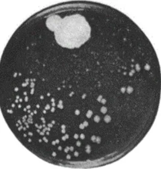 Figura 1: Cultura original que culminou na descoberta da penicilina. Na parte superior  da figura é possível observar o crescimento do fungo Penicillium notatum, junto do qual  o crescimento de Staphylococcus  aureus foi suprimido, enquanto na parte inferi