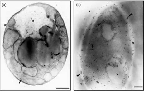 Fig. 2. Immunoelectron microscopy detection of TPI in P. brasiliensis yeast cells by  postembed-ding methods
