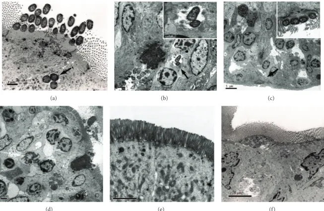 Figure 2: TEM images of rabbit ileal loops infected with aEPEC 1711-4, an isogenic T3SS-mutant or non-pathogenic E