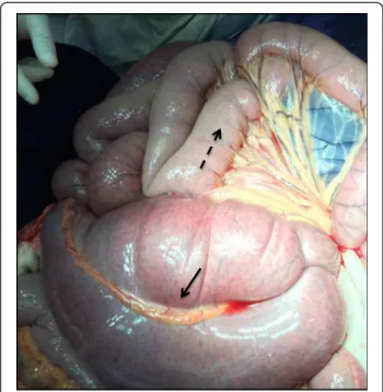 Fig. 1 Abdominal ultrasound of the gelding with tympanic colic as a result of anaphylactic reaction to sodium ceftriaxone