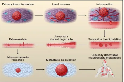 Fig. 8 – The cascade of invasion/metastasis. Tumor cells start by exiting their primary sites  of growth, intravasate into blood flow, travelling systemically until they reach a distant organ  site, where they colonize and growth, originating a distant met