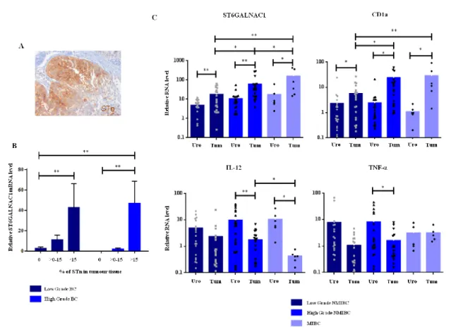 Figure 1. Bladder cancer tissues show differential expression of STn antigen, CD1a, IL-12  and TNF-α cytokines