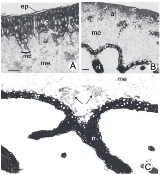 Figure 1. Thallus anatomy of Parmotrema cetratum (Ach.) Hale. (A). Detail of the upper region of the thallus indicating the epicortex (ep), upper cortex (uc), algal  layer (al), maculae (mc) and part of the medulla (me)