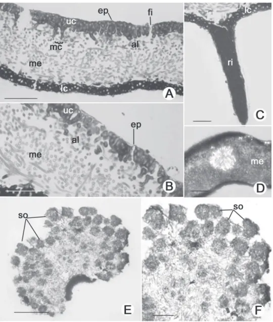 Figure 2. Thallus anatomy of Parmotrema clavuliferum (Räsänen) Streimann. (A). Transverse section showing epicortex (ep), upper cortex (ep), fi ssure (fi ), maculae  (mc), algal layer (al), medulla (me) and lower cortex (lc)