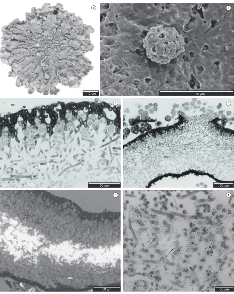 Figure 1. a) General view of Canoparmelia texana; b) Scanning electron microscopy - showing epicortex (ep), pores (pr) and soredia (so); c-f) Light microscopy  - transversal sections; c) Detail of the upper cortex (uc), showing epicortex (ep), lacuna (la) 