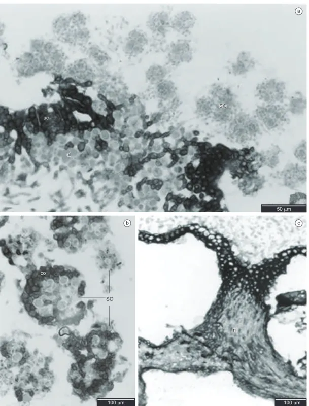 Figure 2. Light microscopy - transversal sections. a) Transversal section showing soralia with soredia (so), upper cortex (uc) and algal layer (al); b) Detail of  granules showing the presence of cortex (co); c) Detail of lower cortex (lc) and rhizine (ri)