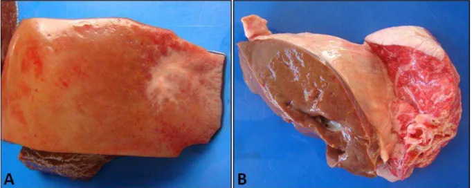 Figura  6.  A  –  Fragmento  de  fígado  de  bovino  criado  em  sistema  intensivo.  Área  focalmente extensa de fibrose capsular