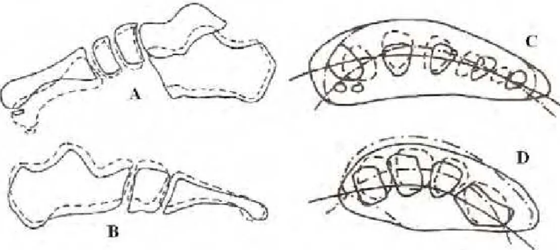 Figura 1.5 – Efeitos da sustentação do peso corporal sobre os arcos do pé (Adaptado de PALASTANGA,  FIELD, SOAMES, 2000) 