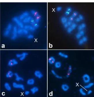 Figura 4. FISH com sonda de DNAr 18S (verde) e histona H3 (vermelho em  (a,b)  e  FISH  com  sonda  de  DNAsn  U1  em  (c,d)