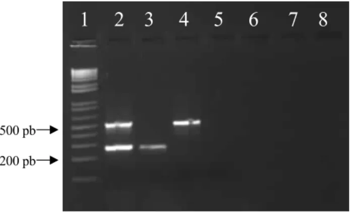Figura 1: Eletroforese em gel de agarose da PCR multiplex de Clostridium chauvoei  e Clostridium septicum
