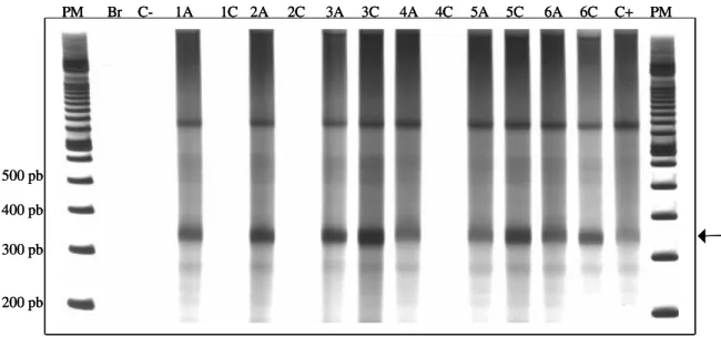 Figura  3  -  Produtos  específicos  de  330pb  do  minicírculo  de  kDNA  do  Trypanosoma  cruzi  obtidos  com  os  iniciadores  S35  e  S36    em  DNA  extraído  do  sangue  de  camundongos  infectados  com  a  cepa  Y,  tratados  com  desferrioxamina  e