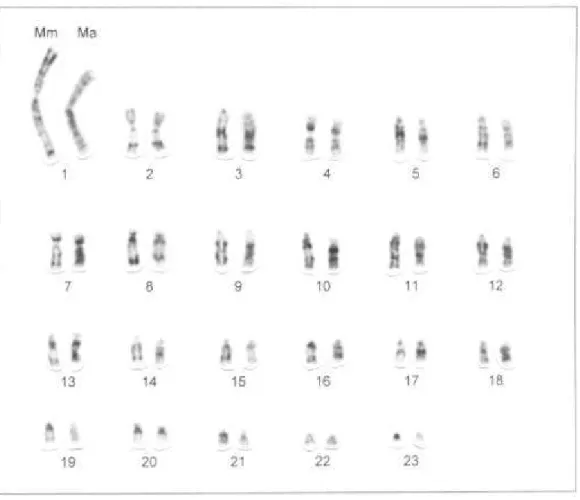 Figura 2: Homologias no padrão de bandas G entre os autossomos das espécies M.  molossus (Mm) e M
