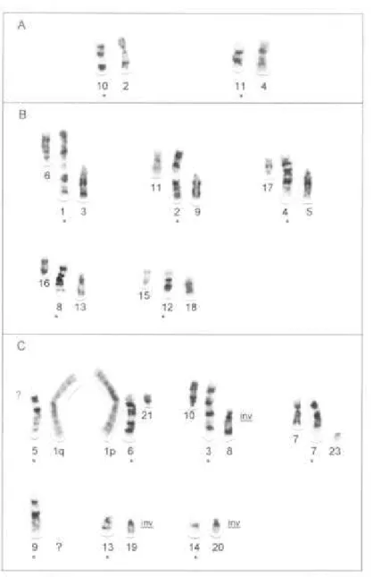 Figura 3: Homologias cromossômicas identificadas entre  A. planirostris  (cromossomos marcados com asterisco) e Molossus