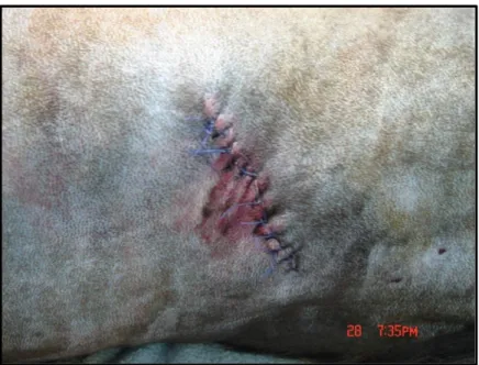 Figura 4  –  Caso Clínico 1. Imagem pós-cirúrgica da área de mordedura (lesão suturada)