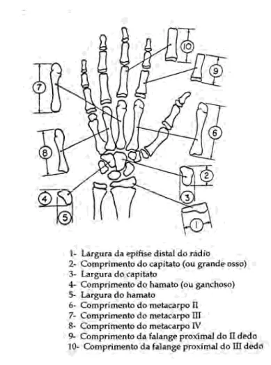 FIGURA 3 – Esquema das 10 medidas lineares em oito centros de ossificação da mão e punho, utilizados para a estimativa da idade óssea, pelo método de Eklöf &amp; Ringertz 21 , 1967