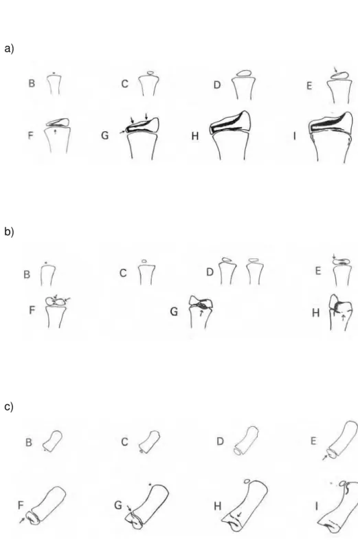 FIGURA 5 – Estágios de maturação óssea: a) para o rádio; b) para a ulna; c) para o metacarpo I
