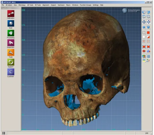Figure 2.3: Acquired skull from the Breuckman Smartscanner - proprietary software