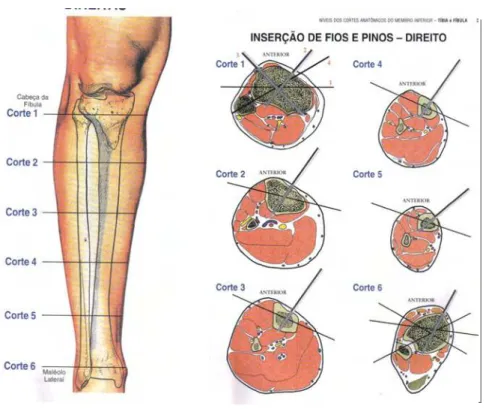 Figura 2.3 – Corredores de segurança da perna (Catagni, 2002) 