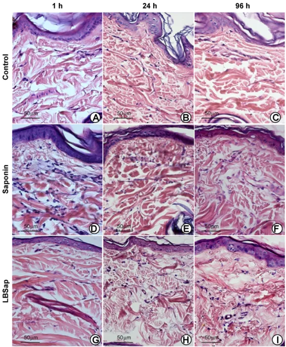 Fig. 1. Photomicrographs of the dermis of dogs immunized with saline (upper panels; control), saponin (middle panels) or LBSap (antigen of L