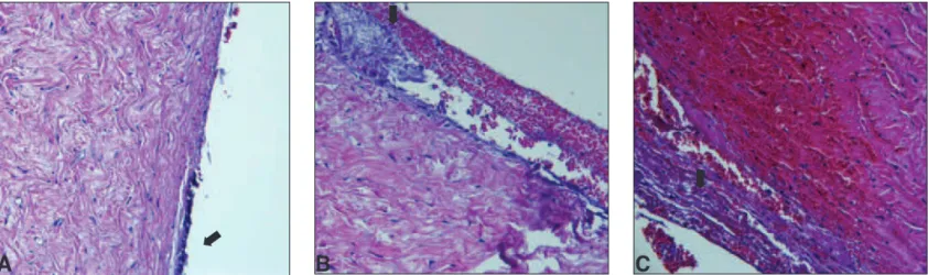 Figura 2: Cortes histológicos referentes à reação de reparação tecidual formada entre a esclera e os cones no M1 (seta); A) Biovidro; B)  Biosilicato FI; C) Biosilicato FII; em todos os cortes nota-se a pseudocápsula, formada por fibroblastos, hemácias e c