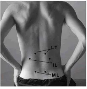 Figura 1-  Localização  dos  pontos  para  o  posicionamento  bilateral  dos  eletrodos  sobre  os  músculo  longuíssimo  do  tórax  (LT),  iliocostal  lombar  (IL)  e  múltífido lombar (ML)