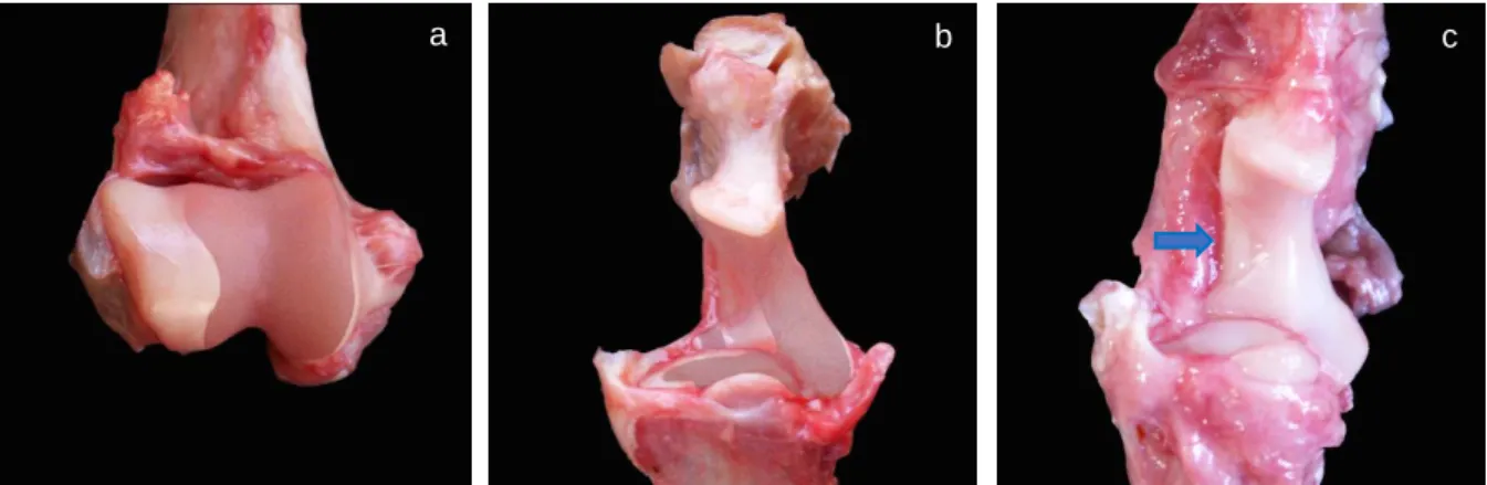 Figure 3.7 Relation between elbow loading distribution and type of UTN cartilage covering
