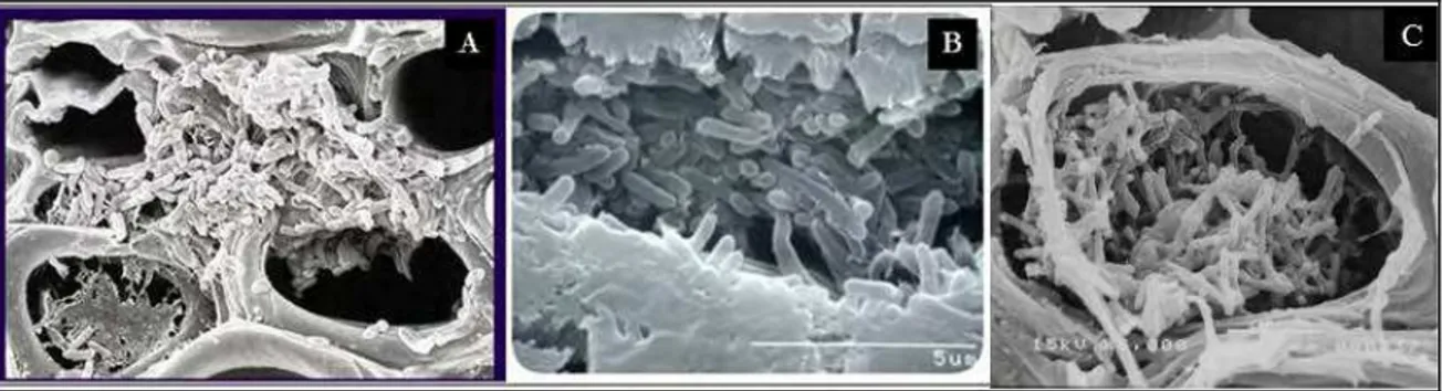 Figura 2: Micrografías eletrónicas de um vaso do xilema contendo células de X. fastidiosa