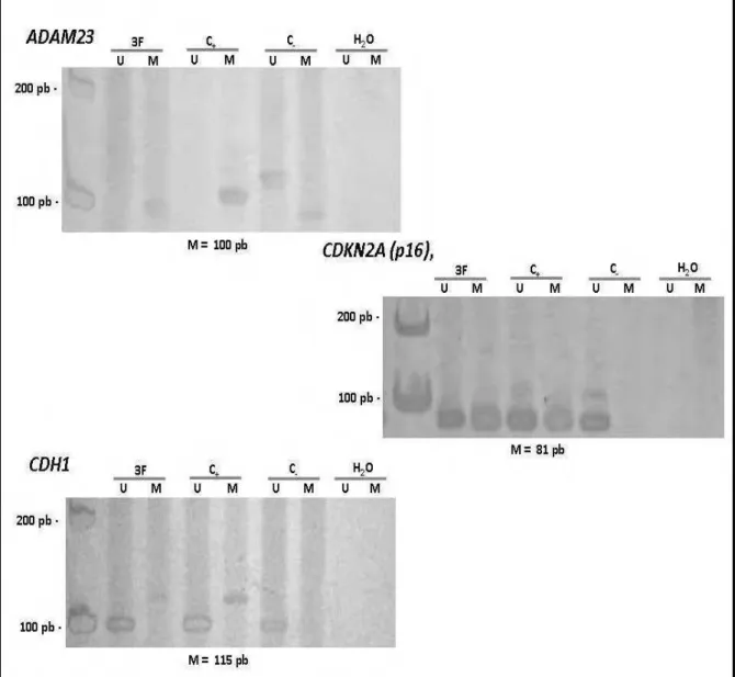 Figure 1. Representative examples of MSP reaction for genes ADAM23, CDH1 and  CDKN2A (p16)