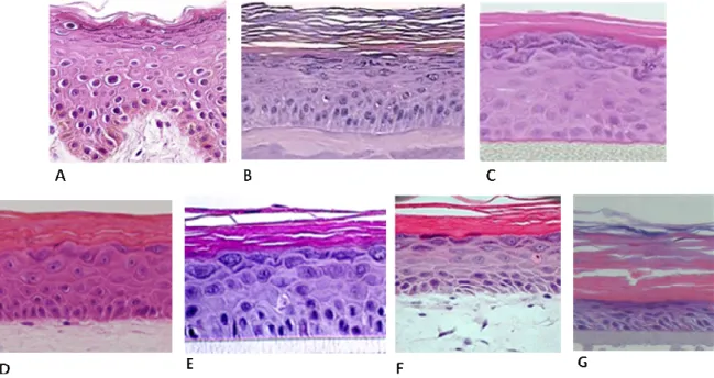 Figure 1.6 - Morphology of human skin and different in vitro dermal permeation models (A) normal human skin  epidermis,  (B)  EpiSkin TM   model,  (C)  EpiDerm TM   model,  (D)  StrataTest TM ,  (E)  SkinEthic TM   RHE  model,  (F)  Epiderm FT TM  and (G) 