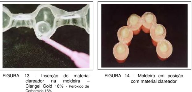 FIGURA 13  - Inserção do material  clareador na moldeira  – Clarigel Gold 16%   - Peróxido de  Carbamida 16% 