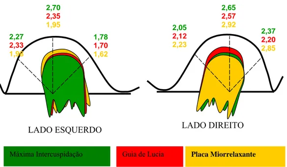 Gráfico 2- Disposição dos côndilos do lado esquerdo e direito nas três posições  analisadas por meio da ressonância nuclear magnética