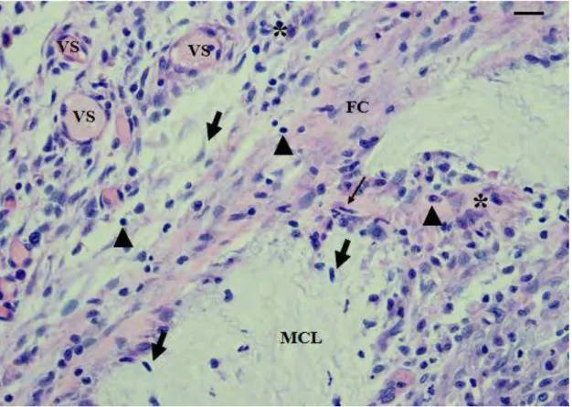 Figura 5: Corte histológico da pele de rato Wistar com implantes de matriz de colágeno  liofilizada (MCL), correspondendo ao grupo AV 15 dias: região da derme - Vasos  Sanguíneos (VS), Fibroblastos (seta Cheia) Infiltrado de células mononucleares  (Cabeça 