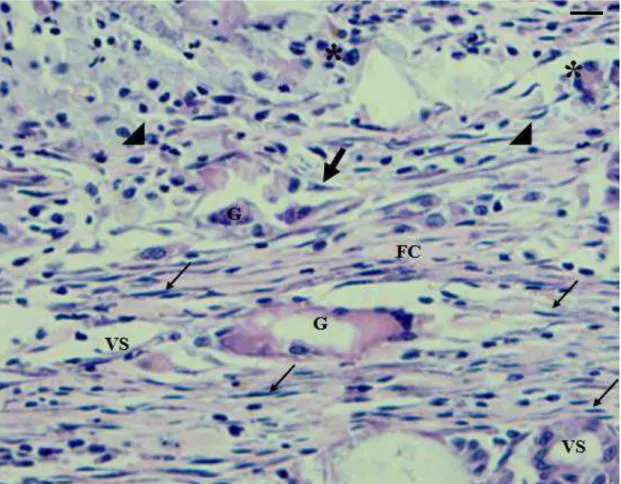Figura 8: Corte histológico da pele de rato Wistar com implantes de matriz de colágeno  liofilizada (MCL), correspondendo ao grupo AV 45 dias: região da derme – Fibras  Colágenas (FC) Fibroblastos (seta cheia), Fibrócitos (seta fina), Macrófagos  (asterisc