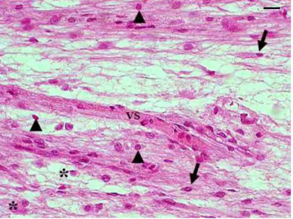 Figura 9. Corte histológico da pele de rato Wistar com implante de matriz de colágeno  liofilizada (MCL), correspondendo ao grupo SF 15 dias: região da derme -  Vaso Sanguíneo (VS), Fibroblastos (seta cheia), Linfócitos (cabeça de seta),  Macrófagos (aster