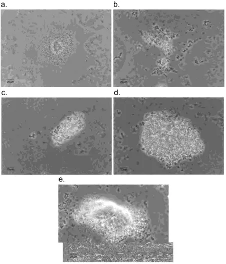 Figura 3. Biofilme de Xylella fastidiosa. Crescimento celular em superfícies de vidro  visualizadas em microscopia óptica durante diferentes estádios da formação do  biofilme