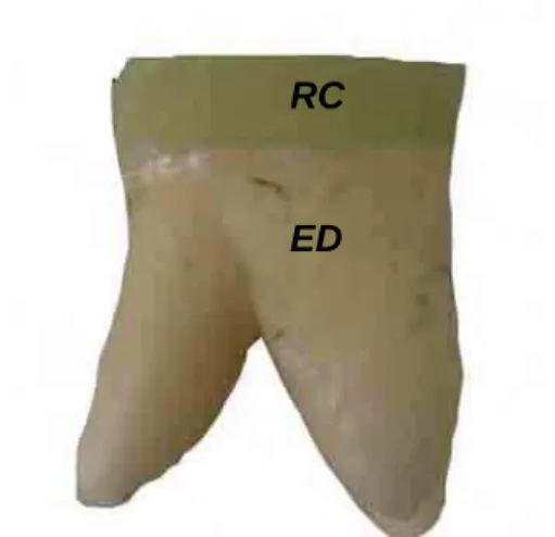 FIGURA 3 – CONJUNTO FORMADO POR RESINA COMPOSTA (RC) E  ESTRUTURA DENTAL (ED) 