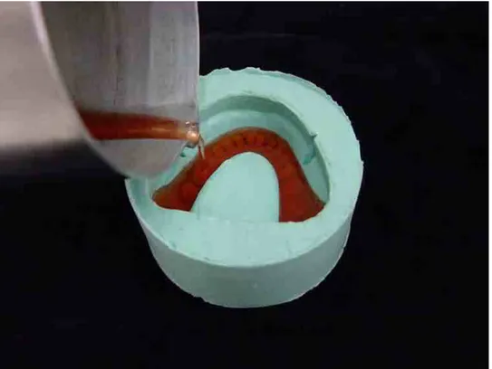 FIGURA 3 – Cera liquefeita sendo vertida no interior da matriz de silicone    com os dentes artificiais previamente posicionados