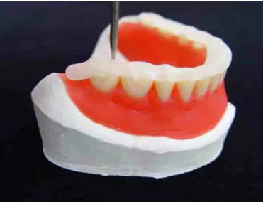 FIGURA 8a – Estilete  FIGURA 8b – Estilete posicionado sobre a  guia de resina e perfurando o dente  artificial 