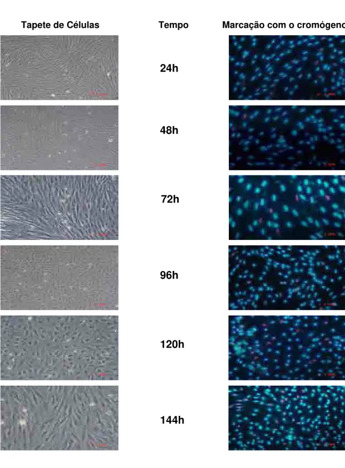 Figura 11 – Viabilidade Celular – Teste Pré-congelação (aumento 200x) – Relação  entre o tapete de células e a marcação com o cromógeno fluorescente para os  grupos de privação de soro e confluência 