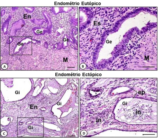 Figura 4. Análise histopatológica de endométrios eutópico e ectópico. [A] Glândulas  endometriais  (Ge)  em  endométrio  eutópico  (En)  na fase  proliferativa
